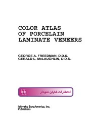 Color atlas of porcelain laminate veneers