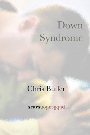 Down Syndrome
